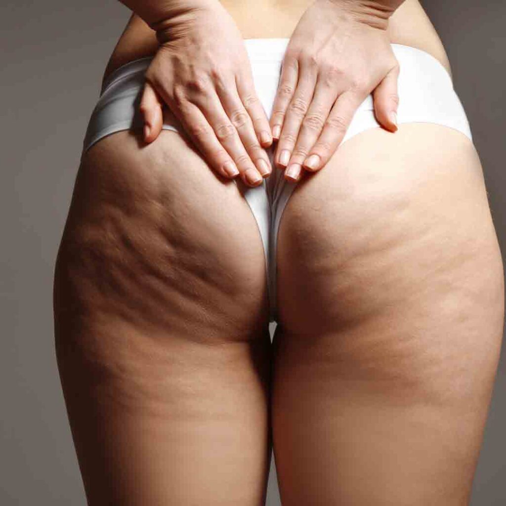 dieta drastica glutei